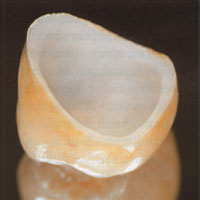 Corona de ZIRCONIO