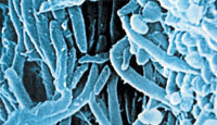 Plaque